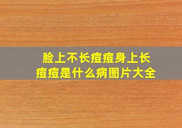 脸上不长痘痘身上长痘痘是什么病图片大全