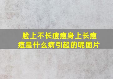 脸上不长痘痘身上长痘痘是什么病引起的呢图片