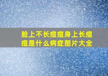 脸上不长痘痘身上长痘痘是什么病症图片大全