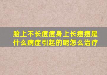 脸上不长痘痘身上长痘痘是什么病症引起的呢怎么治疗