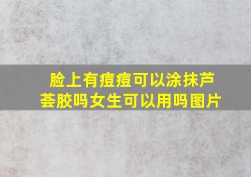 脸上有痘痘可以涂抹芦荟胶吗女生可以用吗图片