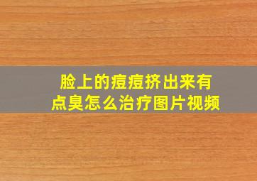 脸上的痘痘挤出来有点臭怎么治疗图片视频