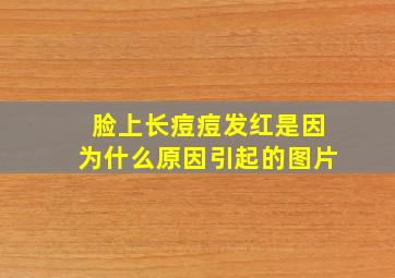 脸上长痘痘发红是因为什么原因引起的图片