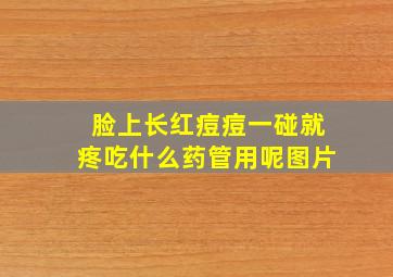 脸上长红痘痘一碰就疼吃什么药管用呢图片