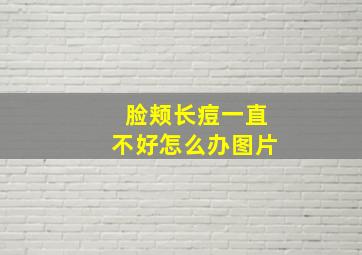 脸颊长痘一直不好怎么办图片