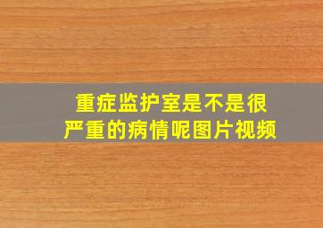 重症监护室是不是很严重的病情呢图片视频