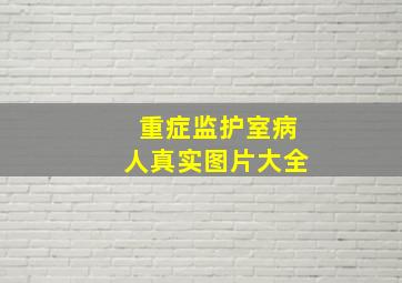 重症监护室病人真实图片大全