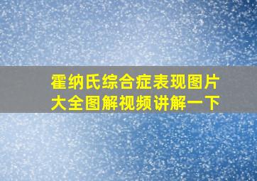 霍纳氏综合症表现图片大全图解视频讲解一下